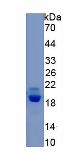 RPA199Hu01.jpg