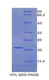 Recombinant Growth Arrest Specific Protein 6 (GAS6)