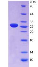 Recombinant Growth Arrest Specific Protein 6 (GAS6)