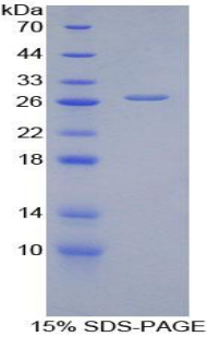 Recombinant Alanine Aminotransferase (ALT)