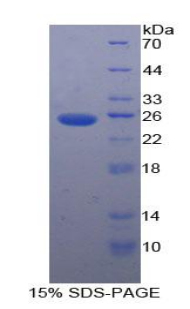 Recombinant Pyruvate kinase isozymes R/L (PKLR)