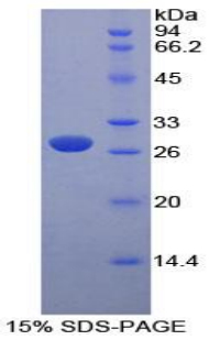 Recombinant Pyruvate kinase isozymes R/L (PKLR)