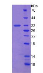 Recombinant Collagen Type I Alpha 2 (COL1a2)