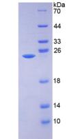 Recombinant Alpha-1-Microglobulin (a1M)