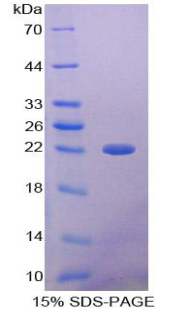 Recombinant Alpha-1-Microglobulin (a1M)