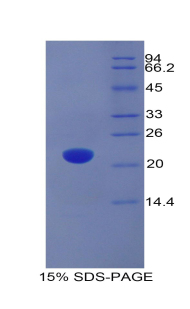 Recombinant Adrenomedullin (ADM)