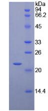 Recombinant Interferon Beta (IFNb)