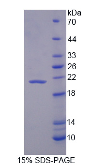 Recombinant Interleukin 1 Receptor Antagonist (IL1RA)