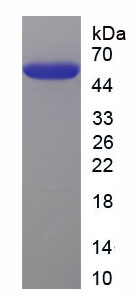 Recombinant Matrix Metalloproteinase 11 (MMP11)