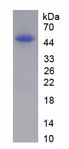 Recombinant Atrial Natriuretic Peptide (ANP)