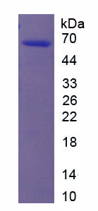 Recombinant Anti-Mullerian Hormone (AMH)