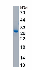 Recombinant Interleukin 2 Receptor Beta (IL2Rb)