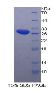 Recombinant Interleukin 2 Receptor Beta (IL2Rb)