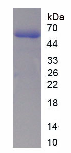 Recombinant Complement 1 Inhibitor (C1INH)