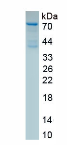 Recombinant Complement 1 Inhibitor (C1INH)