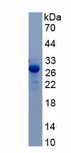 Recombinant Tyrosinase (TYR)