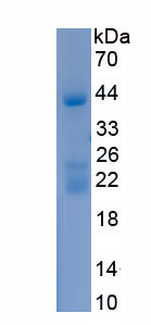 Recombinant Paraoxonase 1 (PON1)