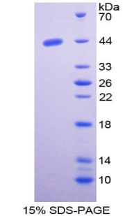 Recombinant Nischarin (NISCH)