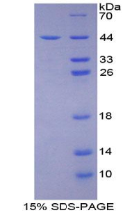 Recombinant Nischarin (NISCH)