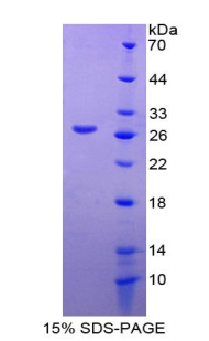 Recombinant N-Acetylgalactosamine-6-Sulfatase (GALNS)