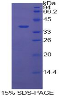 Recombinant Annexin V (ANXA5)