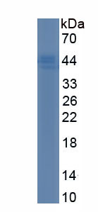 Recombinant Beta-2-Microglobulin (b2M)