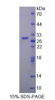 Recombinant Transferrin Receptor 2 (TFR2)