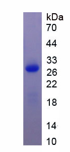 Recombinant Creatine Kinase, Mitochondrial 1A (CKMT1A)