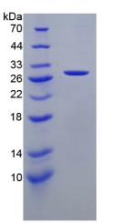 Recombinant Cathepsin K (CTSK)