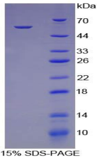 Recombinant Cathepsin K (CTSK)