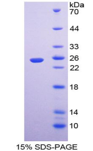 Recombinant Linker For Activation Of T-Cell (LAT)