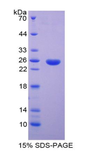 Recombinant Linker For Activation Of T-Cell (LAT)