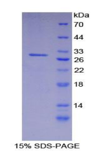 Recombinant Integrin Alpha D (ITGaD)