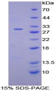 Recombinant Integrin Alpha D (ITGaD)