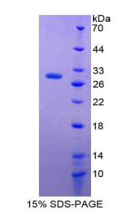 Recombinant Integrin Alpha D (ITGaD)