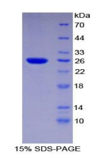 Recombinant Transportin 1 (TNPO1)