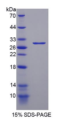 Recombinant Poly ADP Ribose Polymerase (PARP)