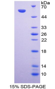 Recombinant Calnexin (CNX)