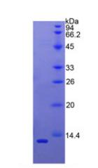 Recombinant B-Cell Activation Factor Receptor (BAFFR)