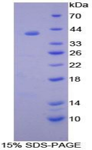 Recombinant B-Cell Activation Factor Receptor (BAFFR)