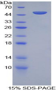 Recombinant B-Cell Activation Factor Receptor (BAFFR)