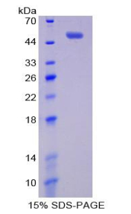 Recombinant B-Cell Activation Factor Receptor (BAFFR)