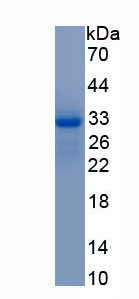 Recombinant Heparin Cofactor II (HCII)