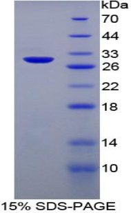 Recombinant Heparin Cofactor II (HCII)