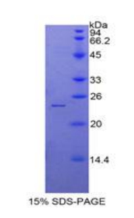 Recombinant Alpha-Fodrin (SPTAN1)