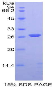 Recombinant Alpha-Fodrin (SPTAN1)