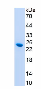 Recombinant Alpha-Fodrin (SPTAN1)