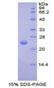 Recombinant Alpha-Fodrin (SPTAN1)