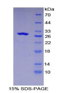 Recombinant Glutamate Dehydrogenase 1 (GLUD1)