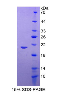 Recombinant Glutathione Peroxidase 1 (GPX1)